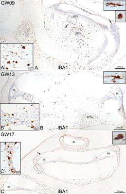 Visualization of macrophage subsets in the development of the fetal human inner ear